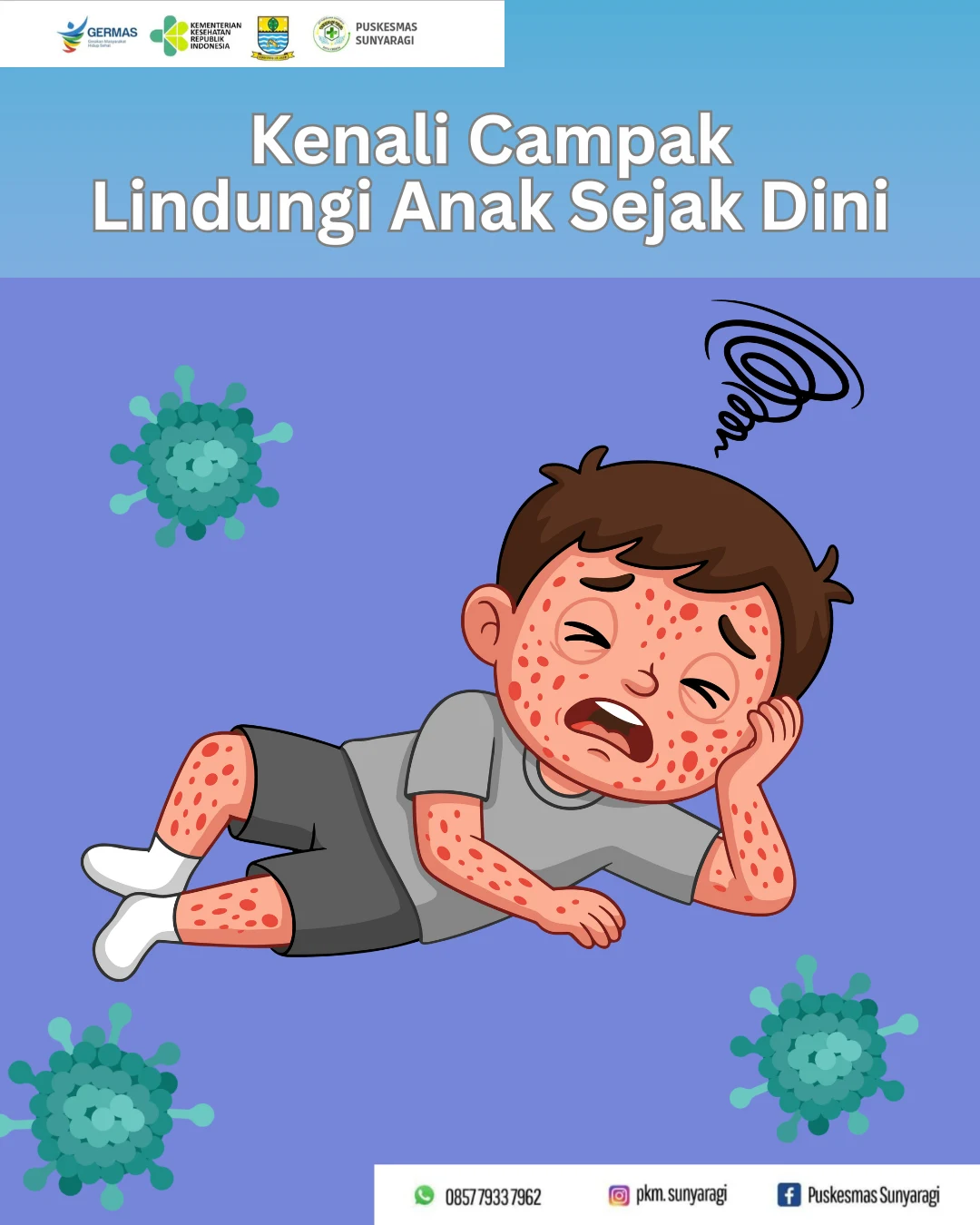 Campak Bisa Dicegah dengan Imunisasi