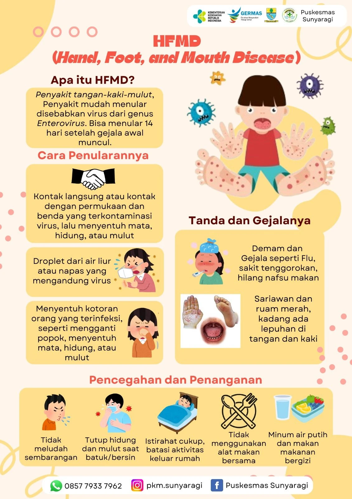 HFMD (Hand, Foot, and Mouth Disease)